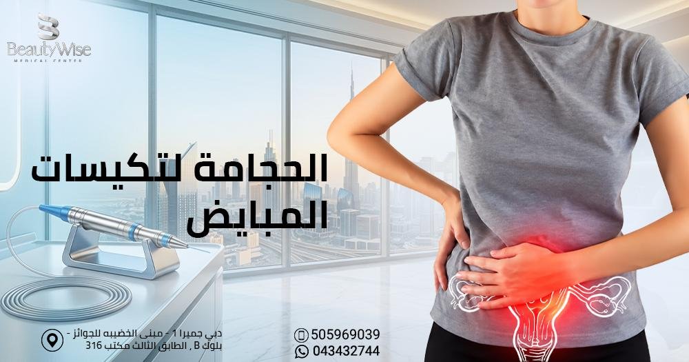 الحجامة لتكيسات المبايض