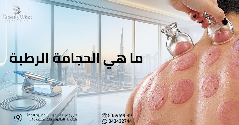 ما هي الحجامة الرطبة