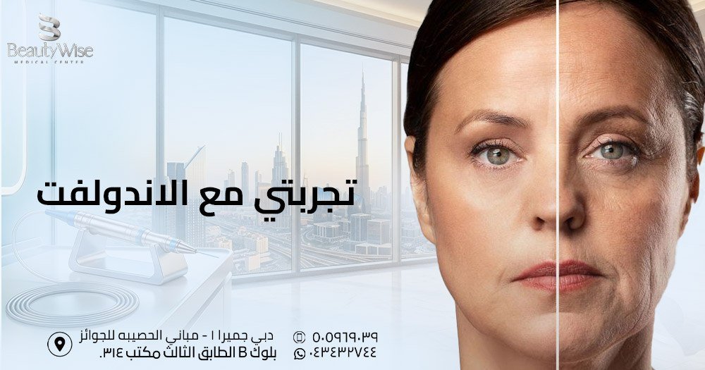 تجربتي مع الاندولفت