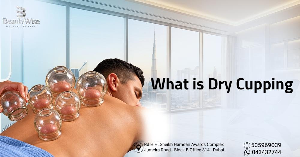 What is Dry Cupping