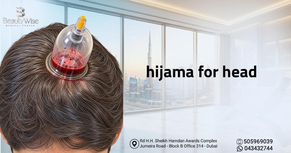 hijama for head